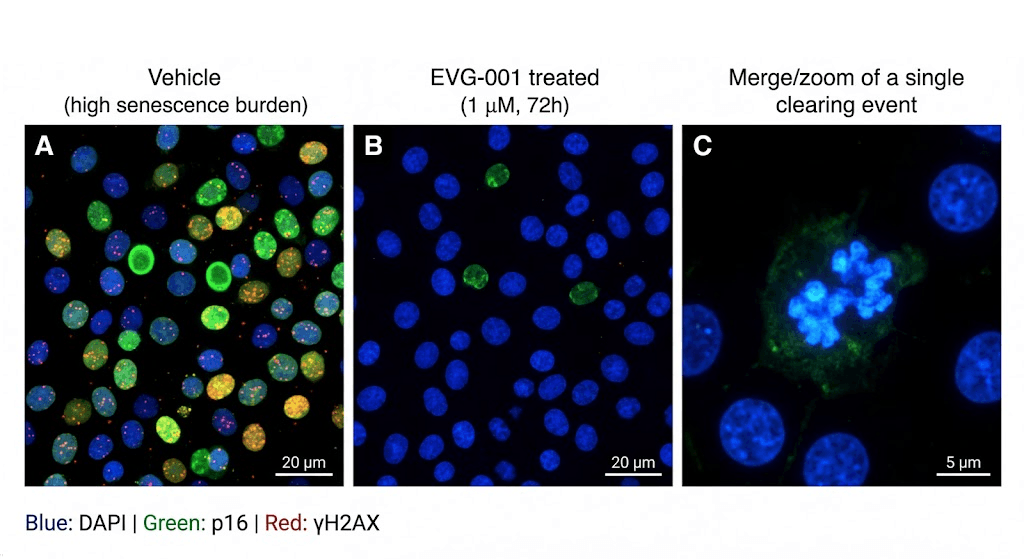 Fig. 3: Immunofluorescence — p16/γH2AX